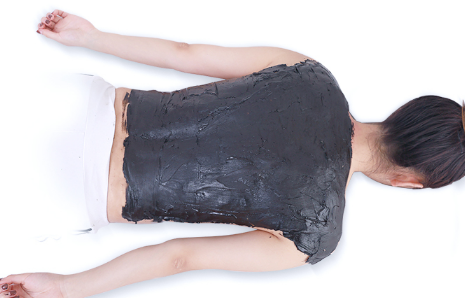 夏天泥灸后出水是热吗