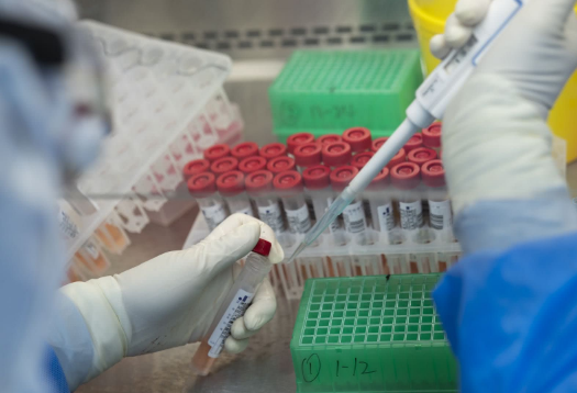 核酸检测给个小瓶干什么用的