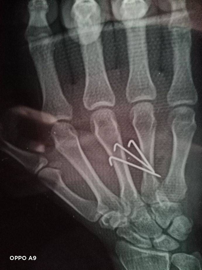 长春骨伤医院(赞长春骨伤医院孟凡琼医师)