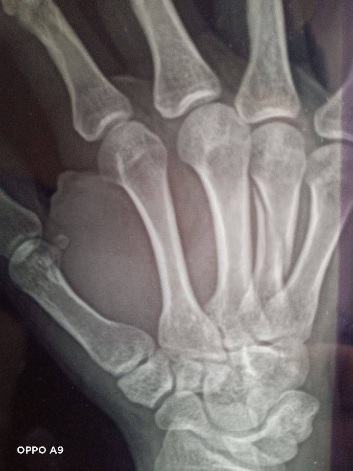 长春骨伤医院(赞长春骨伤医院孟凡琼医师)