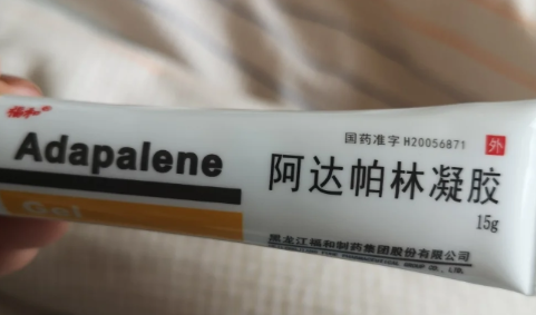 为什么越擦阿达帕林痘痘越多