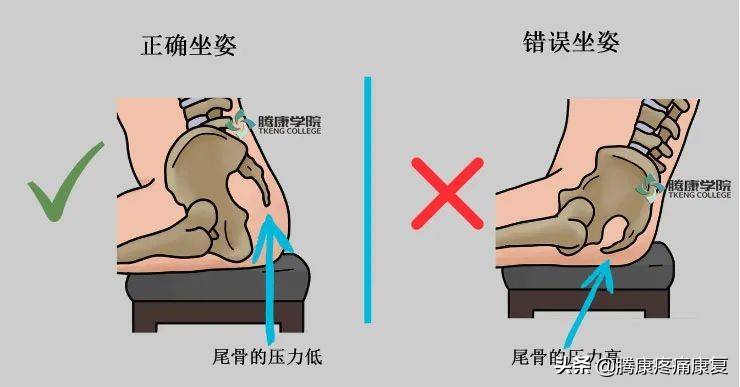 尾巴骨疼(四个缓解尾骨疼痛的方法)