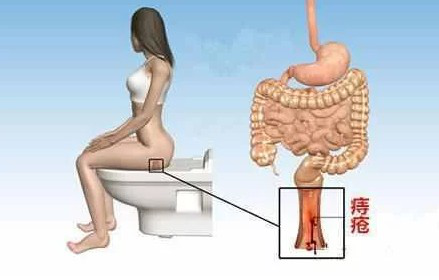 痔疮的危害(痔疮的危害有哪些?)