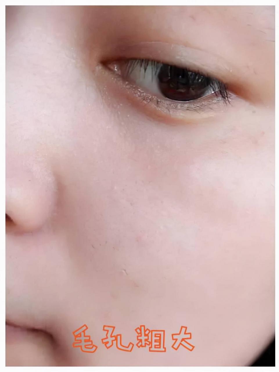 怎样给皮肤补水(学会正确的补水方法)