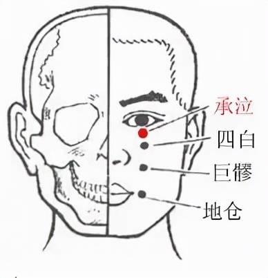 丝竹空穴|（丝竹空位置的痣代表什么）
