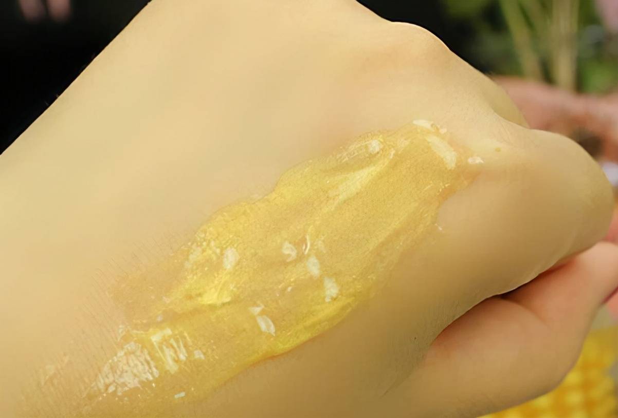 眼周细纹（如何去除眼下细纹）