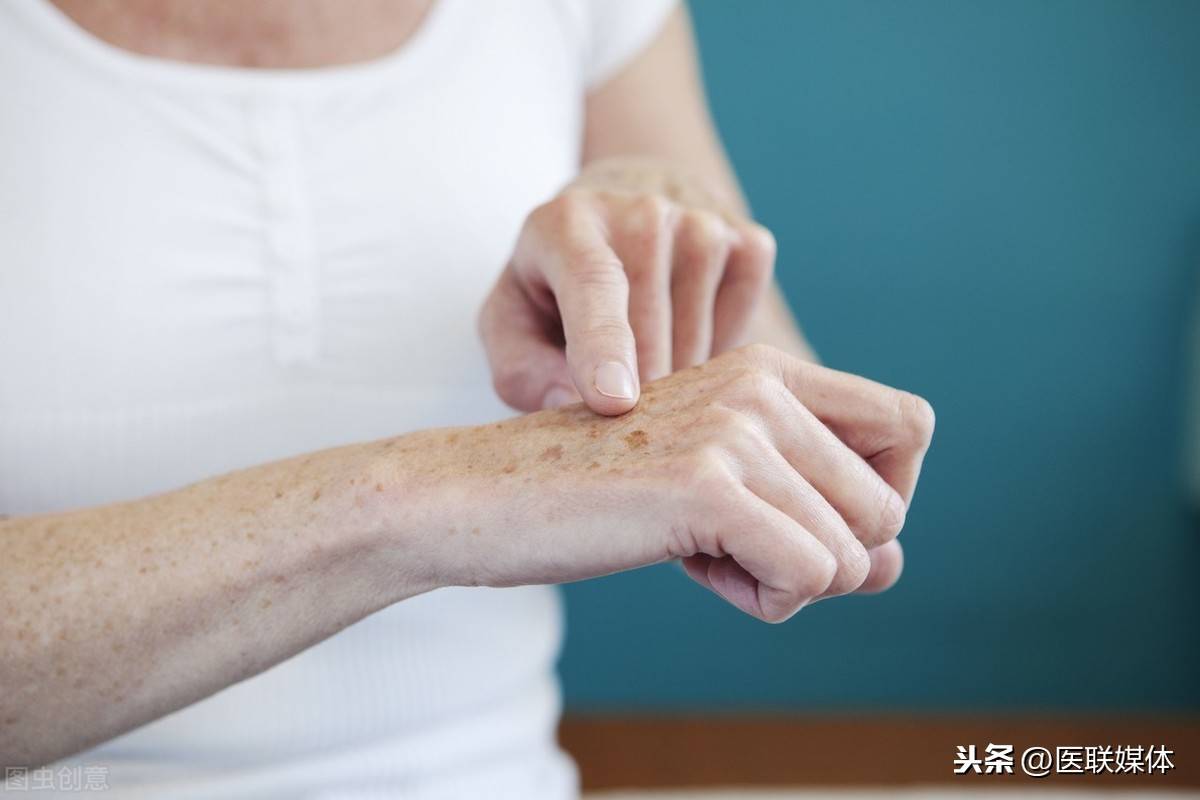 如何减少老年斑(人老了就会长老年斑?)