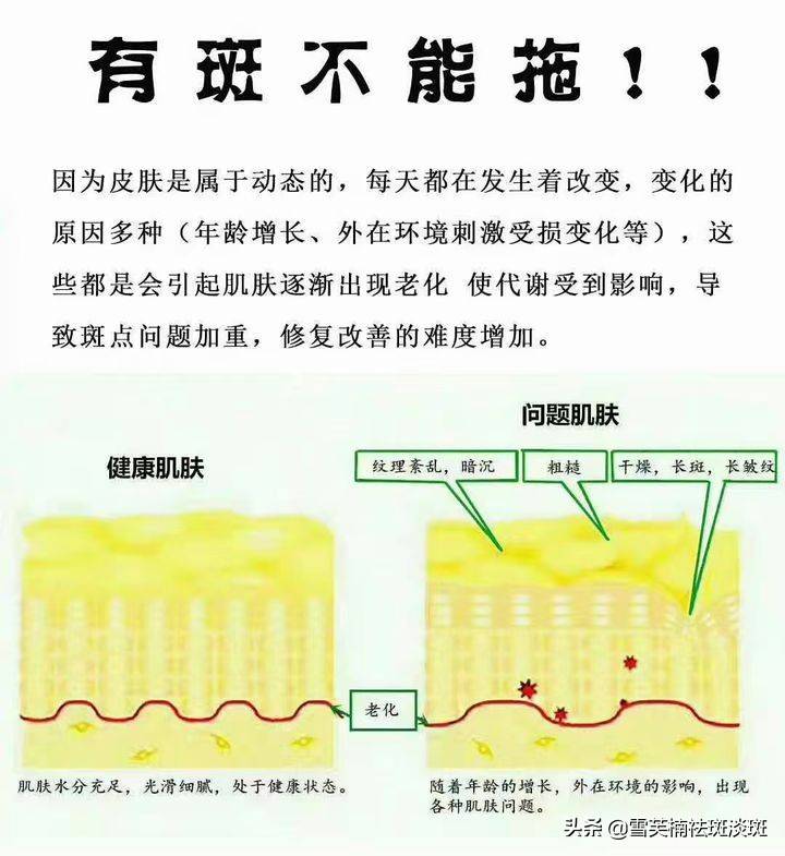 最简单的祛斑方法(简单有效的祛斑方法)