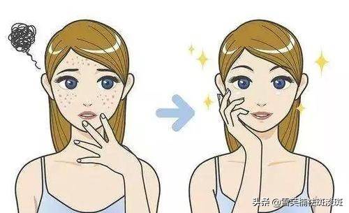 最简单的祛斑方法(简单有效的祛斑方法)