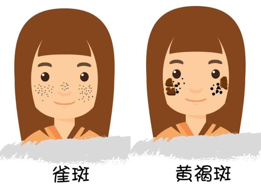 黄褐斑是怎么形成的（黄褐斑究竟是什么原因导致的）
