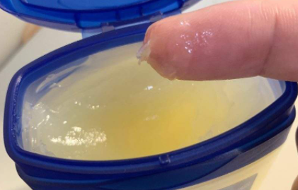 凡士林有没有去黑头的作用