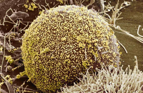 hiv待确诊是不是基本就是了