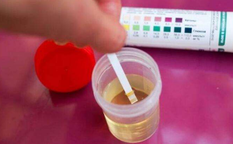 不喝水就基本没尿是肾炎吗