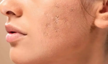 如何防止脸部干燥