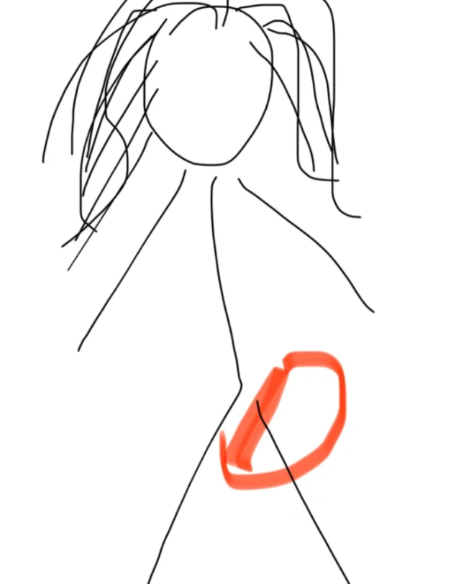 刘畊宏龙拳大腿疼正常吗