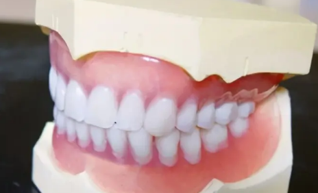 医生不建议清理牙结石有什么说法