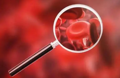 贫血吃什么最好最快的补血