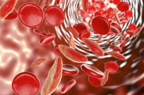 贫血吃什么最好最快的补血