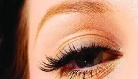 早上醒来眼皮浮肿怎么回事