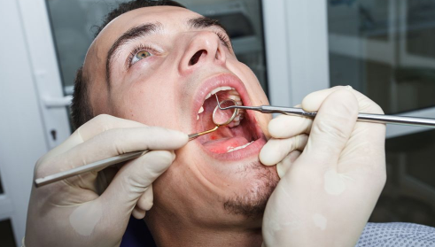 鱼刺卡喉咙怎么办