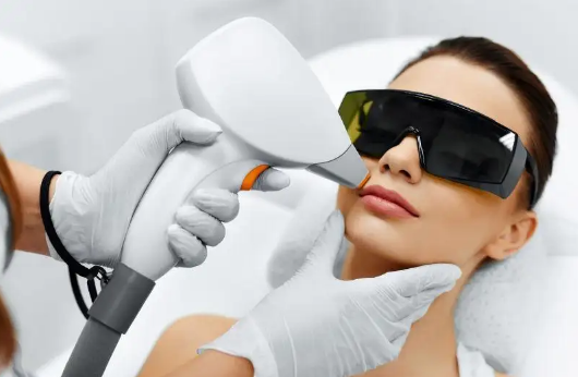 激光脱毛会影响汗腺的排出吗