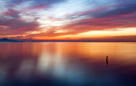 结婚腰镜买几个