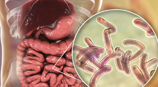 霍乱是传染病吗