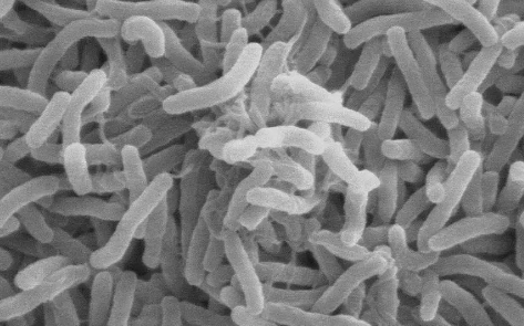 霍乱为什么是甲类传染病