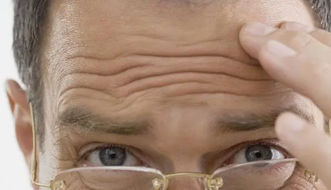 从小就有抬头纹怎么办