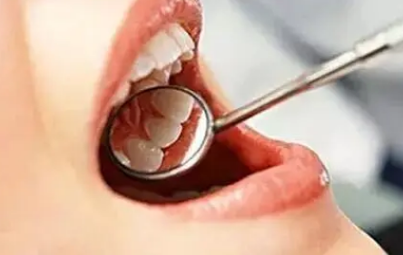 口腔溃疡怎么办最快最有效的方法