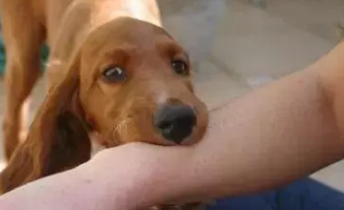 家养狗咬伤有必要打针么