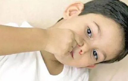 小孩流鼻血是什么原因