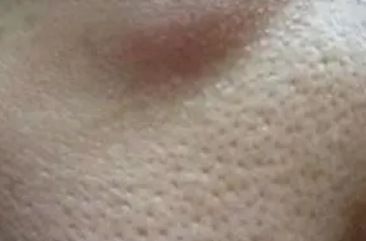 运动能收缩毛孔吗