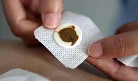 三伏贴一定要贴五次吗