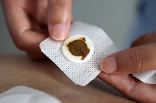 三伏贴贴满三年还需要再贴吗