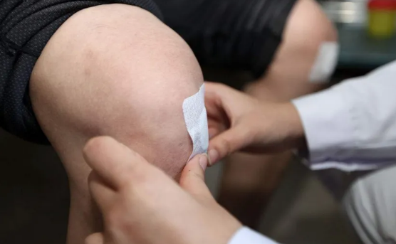 三伏贴只有三伏天才贴吗