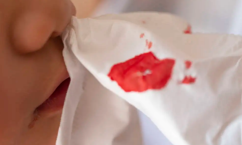 吹空调流鼻血买加湿器有用吗