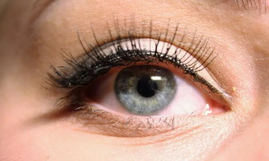 割双眼皮两个月了疤痕疙瘩会消除吗