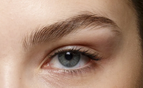 双眼皮宽了怎么补救