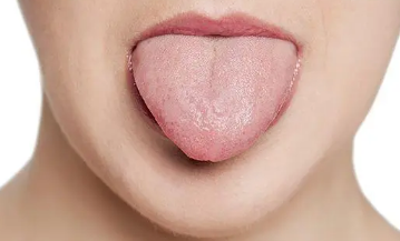 舌头烫起泡了能自己恢复吗