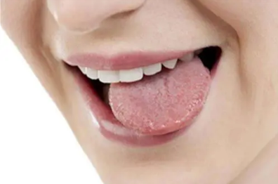 舌头烫起泡了能自己恢复吗