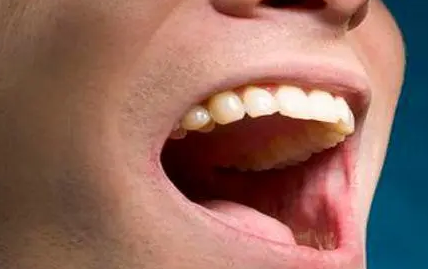 口腔烫的水泡多久能好