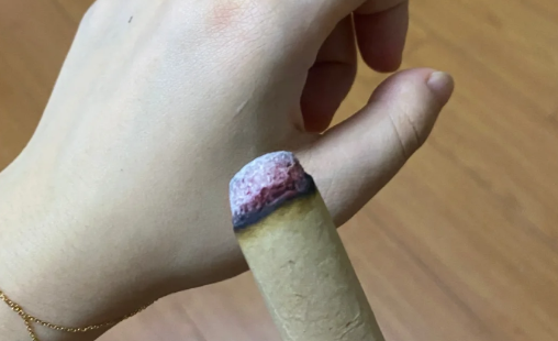 艾灸一年后什么病都出来了真的假的