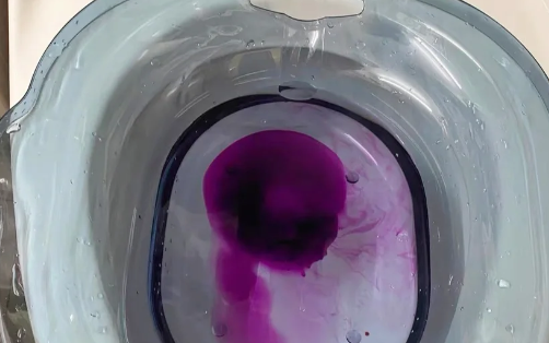 偶尔一次便血正常吗