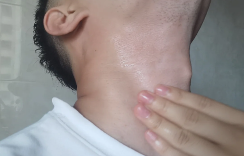 喉咙痛按商阳穴有用吗