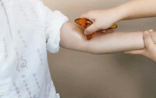 刮痧出现黑紫说明什么 刮痧的痕迹多久才能退 刮痧出现黑紫说明什么?刮痧的功效作用