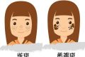 黄褐斑是怎么形成的（黄褐斑究竟是什么原因导致的）