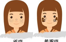 黄褐斑是怎么形成的（黄褐斑究竟是什么原因导致的）